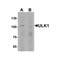 ProSci 7335 ULK1 Antibody