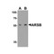ProSci 7465 ARSB Antibody
