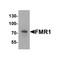ProSci 7707 FMR1 Antibody