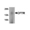 ProSci 7717 CFTR Antibody