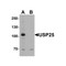 ProSci 7765 USP25 Antibody