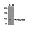 ProSci 7783 PROM1 Antibody