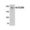 ProSci 7857 TICRR Antibody