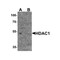 ProSci 7897 HDAC1 Antibody