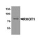 ProSci 8027 RHOT1 Antibody