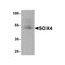 ProSci 8123 SOX4 Antibody