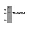ProSci 8131 SLC29A4 Antibody