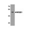 ProSci 8161 WSB1 Antibody