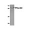 ProSci 8237 PALMD Antibody