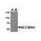 ProSci 8343 SLC38A4 Antibody