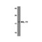 ProSci 8453 IL-11 Antibody