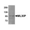 ProSci 8547 MLXIP Antibody