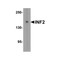 ProSci 8631 INF2 Antibody