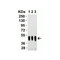 ProSci 9103 SARS-CoV-2 (COVID-19) Nucleocapsid Antibody