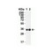 ProSci 9151 SARS-CoV-2 (COVID-19) 3CL-PRO (NSP5) Antibody