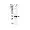 ProSci 9153 SARS-CoV-2 (COVID-19) 3CL-PRO (NSP5) Antibody