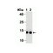 ProSci 9163 SARS-CoV-2 (COVID-19) NSP9 Antibody