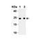 ProSci 9169 SARS-CoV-2 (COVID-19) Envelope Antibody