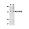 ProSci 2101 GPR15 Antibody