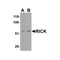 ProSci 2183 RICK Antibody