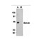 ProSci 2209 Bonzo Antibody