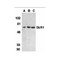 ProSci 2299 DcR1 Antibody