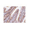 ProSci 2319 CIDE-B Antibody
