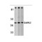 ProSci 2323 DAPK2 Antibody