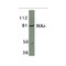 ProSci 2329 IKK epsilon Antibody