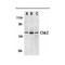ProSci 2391 Chk2 Antibody
