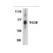 ProSci 2481 TCCR Antibody