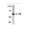 ProSci 2489 IL-22 Receptor Antibody