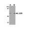 ProSci 2497 IL-22 Receptor Antibody