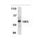 ProSci 2499 CIKS Antibody