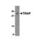 ProSci 3155 TIRAP Antibody