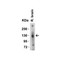 ProSci 3229 ACE2 Antibody