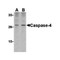 ProSci 3453 Caspase-4 Antibody