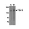 ProSci 3509 TSC2 Antibody