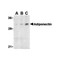 ProSci 3553 Adiponectin Antibody