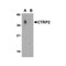 ProSci 3561 CTRP2 Antibody