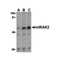 ProSci 3597 IRAK2 Antibody