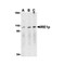 ProSci 3655 IRE1p Antibody