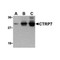 ProSci 3673 CTRP7 Antibody