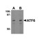 ProSci 3681 ATF6 Antibody