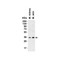 ProSci 3963 sRANK Ligand Antibody