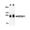 ProSci 4081 BRSK1 Antibody