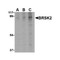 ProSci 4085 BRSK2 Antibody