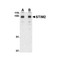 ProSci 4123 STIM2 Antibody