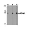 ProSci 4125 STIM2 Antibody