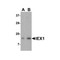 ProSci 4247 IEX-1 Antibody